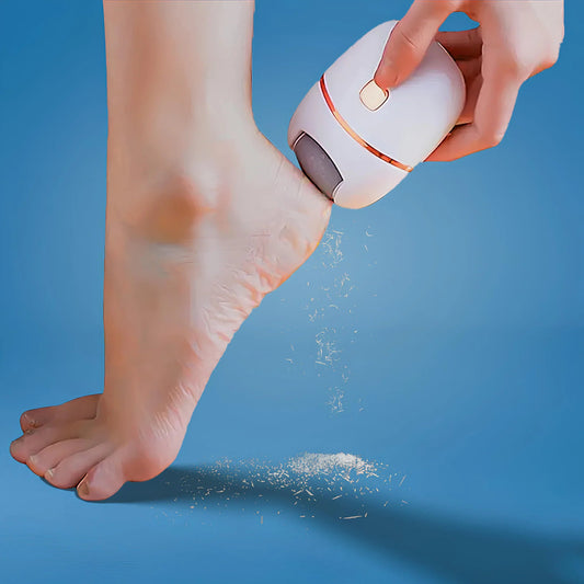 Callus remover