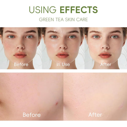 Green Tea Skincare Routine Set, Soothe Skin Care Gift, Deep Cleaning, Oil Control, Moisturize & Improve Skin, Facial Care with Cleanser, Toner, Serum, Eye Cream and Face Cream