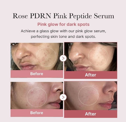 PDRN Pink Peptide Serum 30Ml